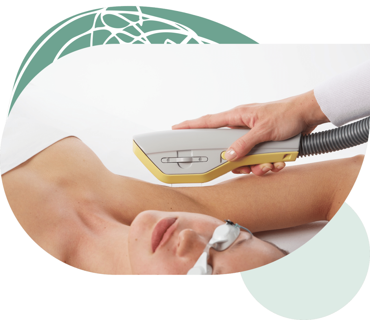 Epilácia s IPL EXILITE | Revité Senica