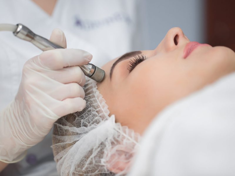 Diamond microdermabrasion, peeling cosmetic. woman during a microdermabrasion treatment in beauty salon